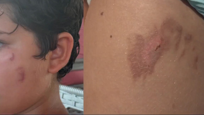 Denize giren korkunç halde çıkıyor! Hastaneler doldu taştı, nedeni belli oldu