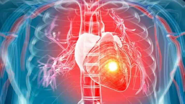 Tropikal fırtınalar sonrası kalp damar hastalıkları şikayetleri arttı