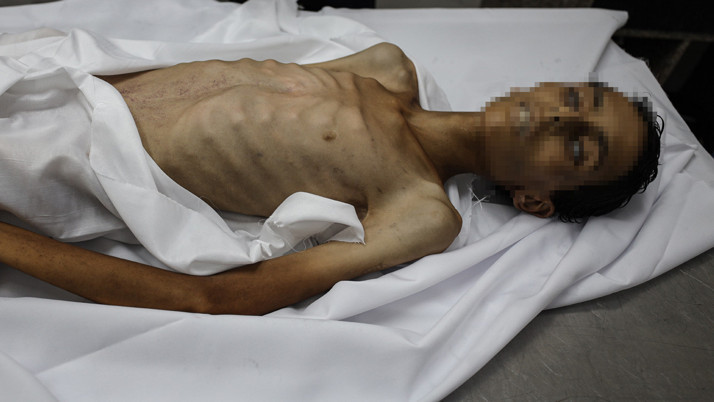 Gazze'de 6 kişi daha açlıktan hayatını kaybetti!