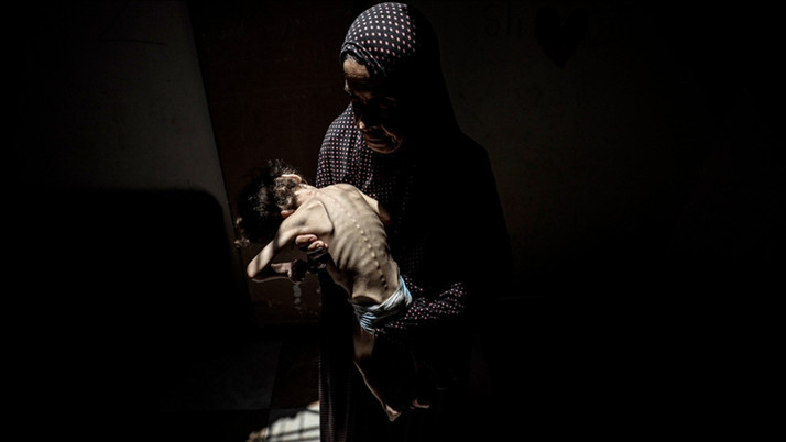 Gazze'de dayanılmaz görüntü Son 24 saatte 5 kişi daha açlıktan hayatını kaybetti