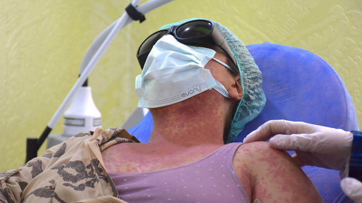 Van'da 4 kişi internet ve aktardan aynı kremi aldı hayatları karardı