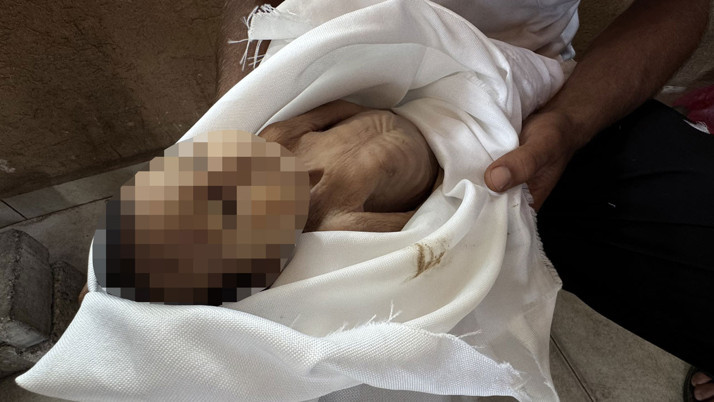 DSÖ: Gazze Şeridi'nde yetersiz beslenmeye bağlı 400 ölüm doğrulandı