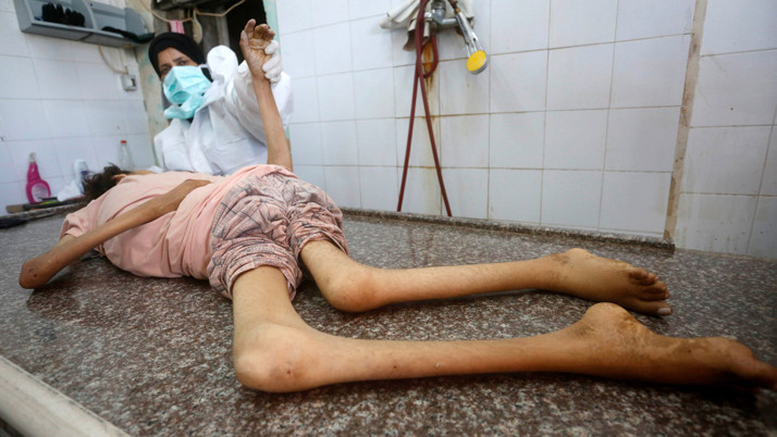 Gazze'de açlıktan ölenlerin sayısı arttı