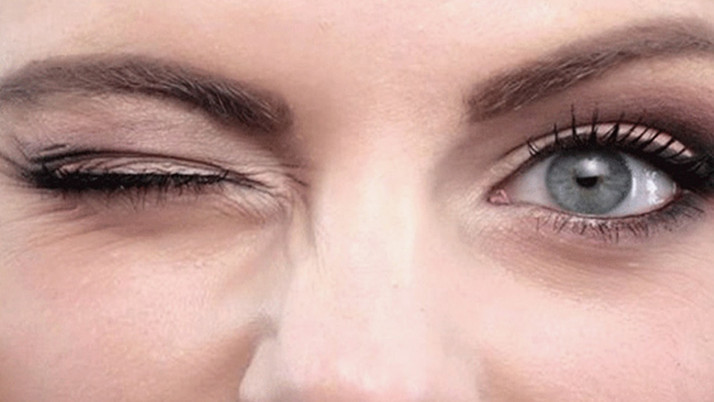 Göz seyirmesi deyip geçmeyin! Asıl sebebi çok başka