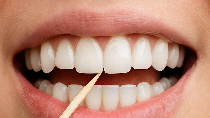 Dişlerini kürdanla temizleyenlerin vay haline: Hiç de masum değil...