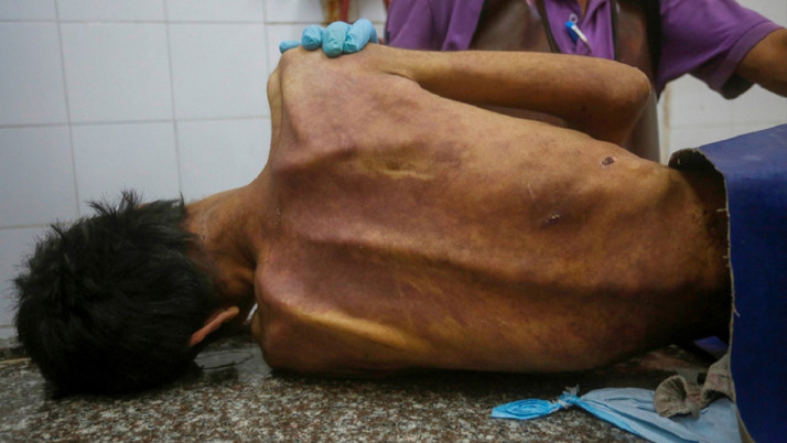 Gazze'de insanlığı utandıran rakam! Açlık nedeniyle 421 kişi can verdi...