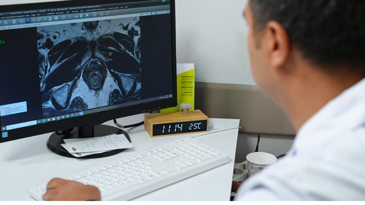 Akıllı biyopsi ile daha doğru tanı, daha etkin tedavi