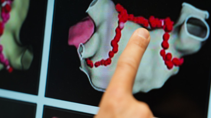 Kalp ritmi bozukluklarında sihirli dokunuş! Ablasyon tedavisiyle kalıcı çözüm!