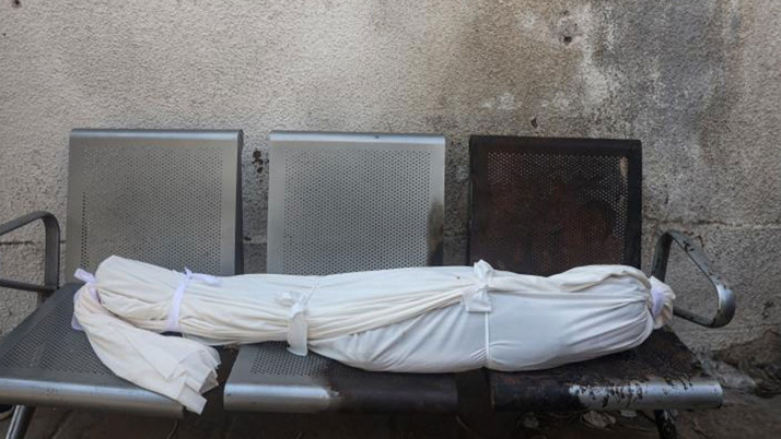 İsrail'in Gazze'ye saldırılarında can kaybı, son 24 saatte 44 artarak 67 bin 913’e çıktı