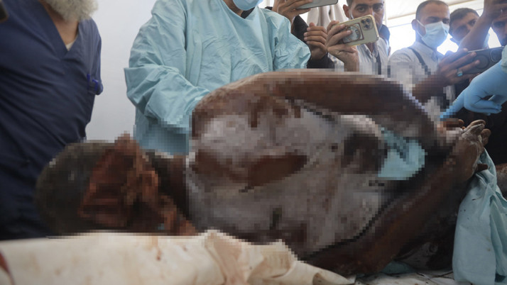 İsrail'in teslim ettiği cenazelerin baş ve göğüs bölgesinde kurşun izleri tespit edildi