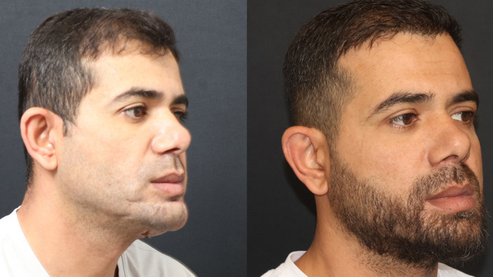 Çenesi parçalandı, umudunu kaybetmedi! Medipol'den başarılı operasyon