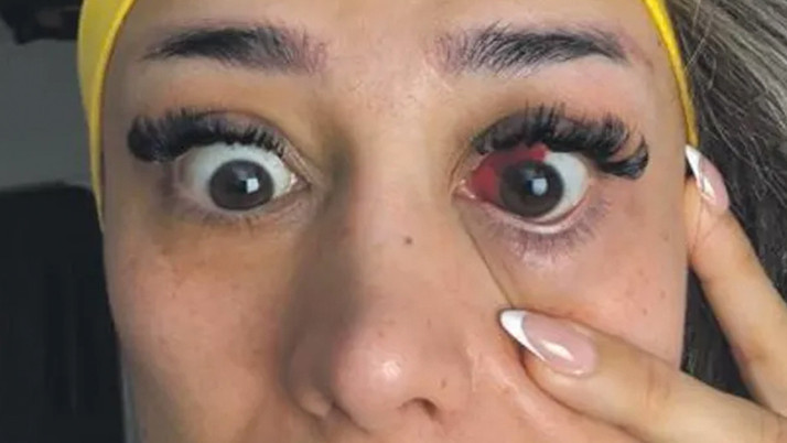 Fitness eğitmeni tavuk döner yedi! Gözü bu hale geldi