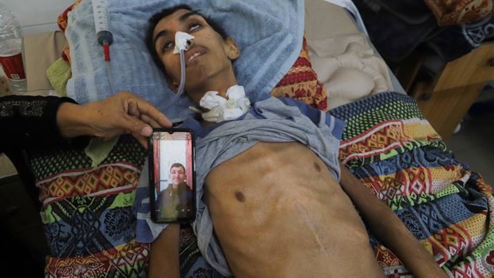 Gazze'de yardım kuyruğunda beklerken vuruldu felç kaldı