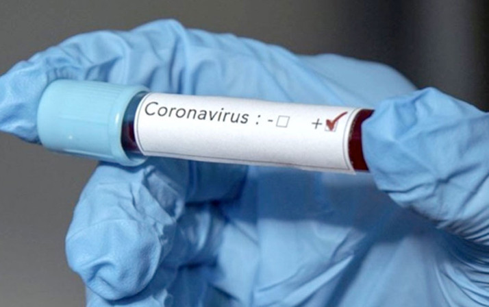 Çinli araştırmacılar insanlara bulaşma riski taşıyan yeni tip koronovirüs tespit etti