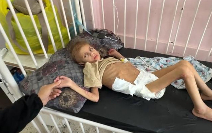 Gazze’de yetersiz beslenme sonucu 12 kiloya düşen 7 yaşındaki May yürüme yetisini kaybetti