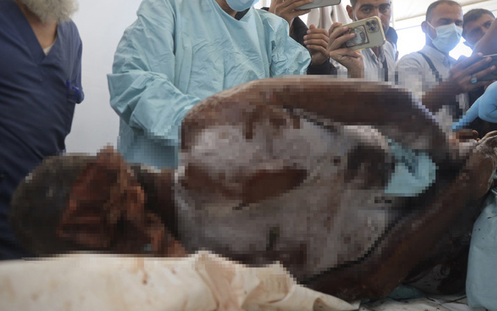 İsrail'in teslim ettiği cenazelerin baş ve göğüs bölgesinde kurşun izleri tespit edildi