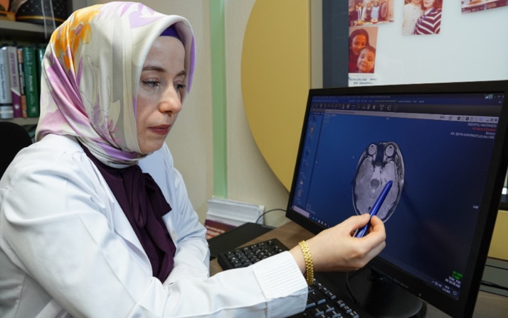 Epilepsi belirtileri gözden kaçabilir! Aileler nelere dikkat etmeli? Epilepside gözden kaçan 5 gizli işaret