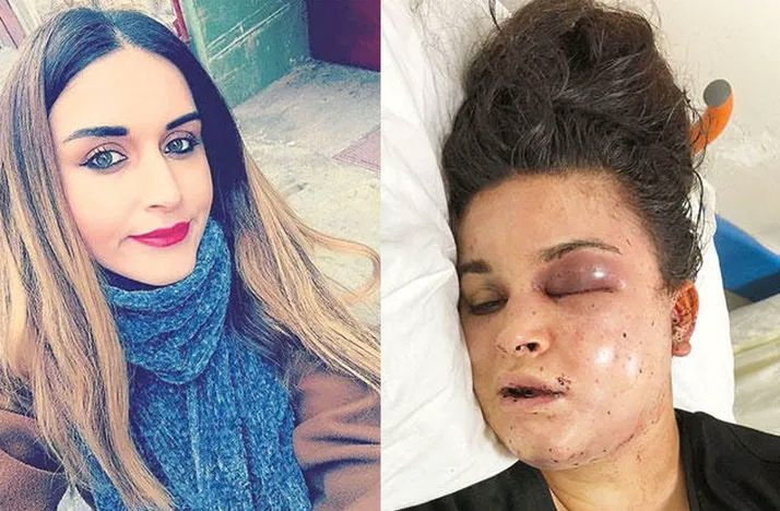 8 saat işkence ettiler! Ya kefen giyeceksin ya da yüzüne kezzabı yiyeceksin... - Resim: 1