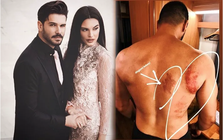 Şampiyon dizisinin başrolü Tolgahan Sayışman dizinin ilk bölümünü izlerken fenalaştı! - Resim: 1