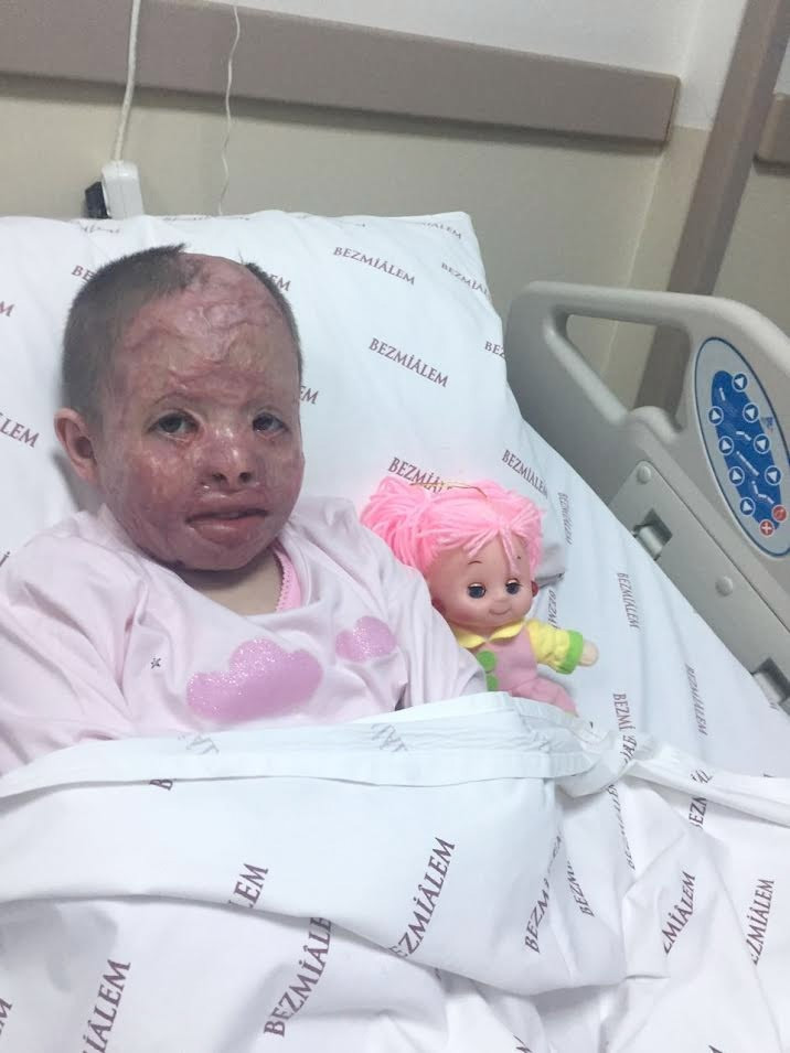 Suriyeli kız çocuğu böyleydi bu hale geldi - Resim: 1