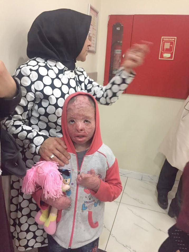 Suriyeli kız çocuğu böyleydi bu hale geldi - Resim: 4