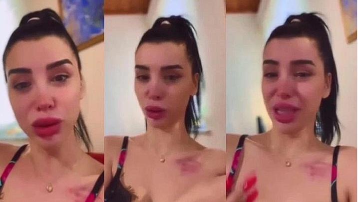 Batuhan Karadeniz'in hapsi isteniyor! Eski sevgilisi Aleyna Eroğlu darp edildiğini iddia etmişti - Resim: 1