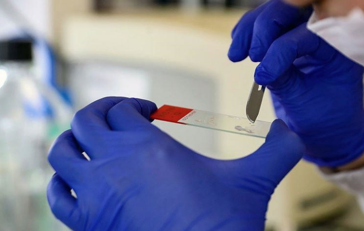 Yerli Covid-19 ilacında geri sayım başladı! İşte gelişmeler - Resim: 3