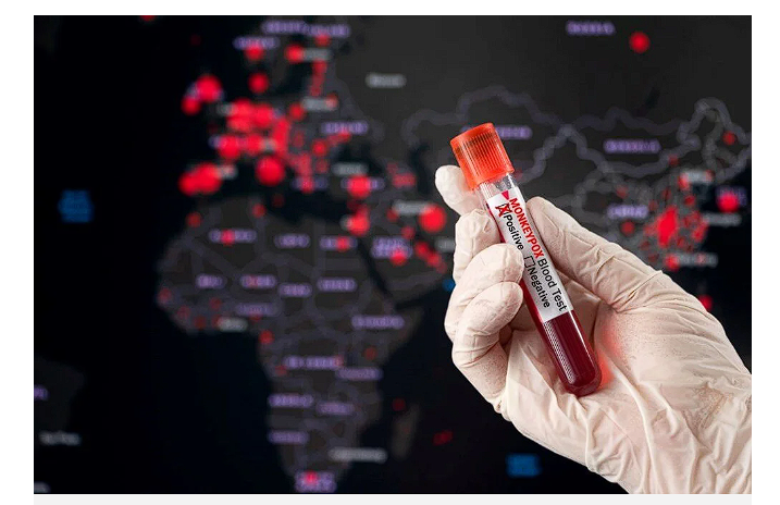 İlk kez görüldü eşcinsel çift bulaştırdı! DSÖ ve CDC'den peş peşe açıklamalar - Resim: 4