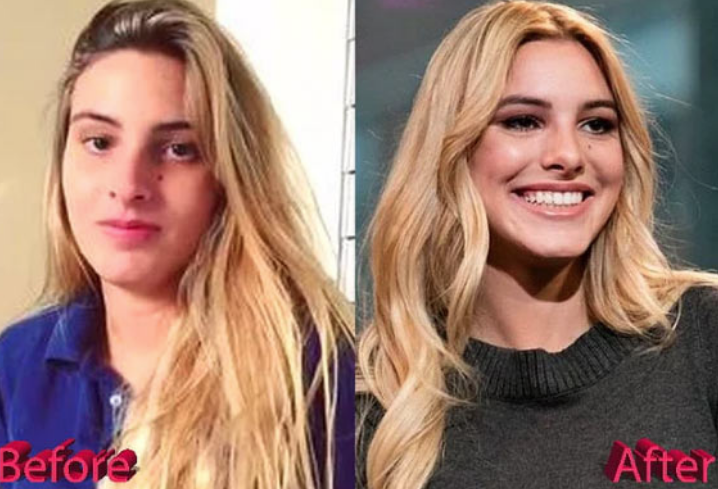 Değişimine kimse inanamadı! Son hali bomba - Resim: 2