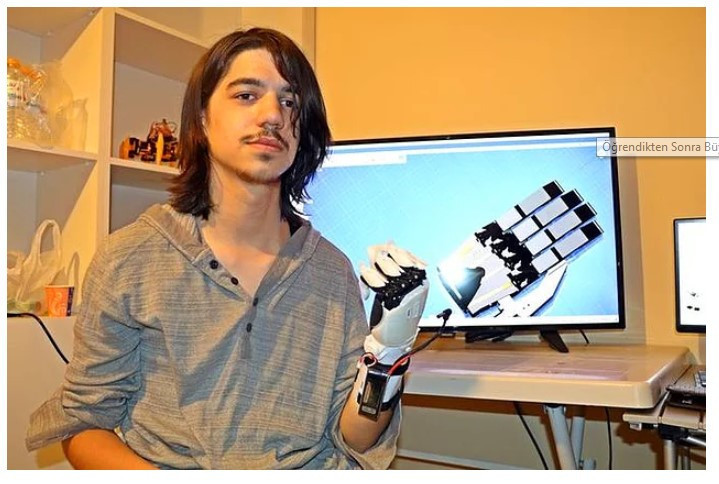 Deney yaparken ellerini kaybetti hayallerinden vazgeçmedi - Resim: 2