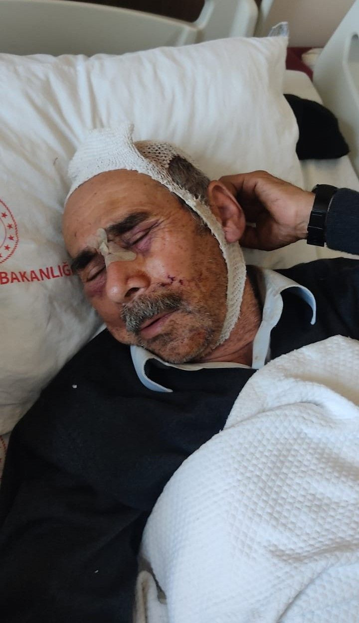 Baston, balta sapı, koltuk değnekleri ile saldırdı! Sinop'ta korkunç olay saatlerce işkence bunu onlara yapan... - Resim: 1