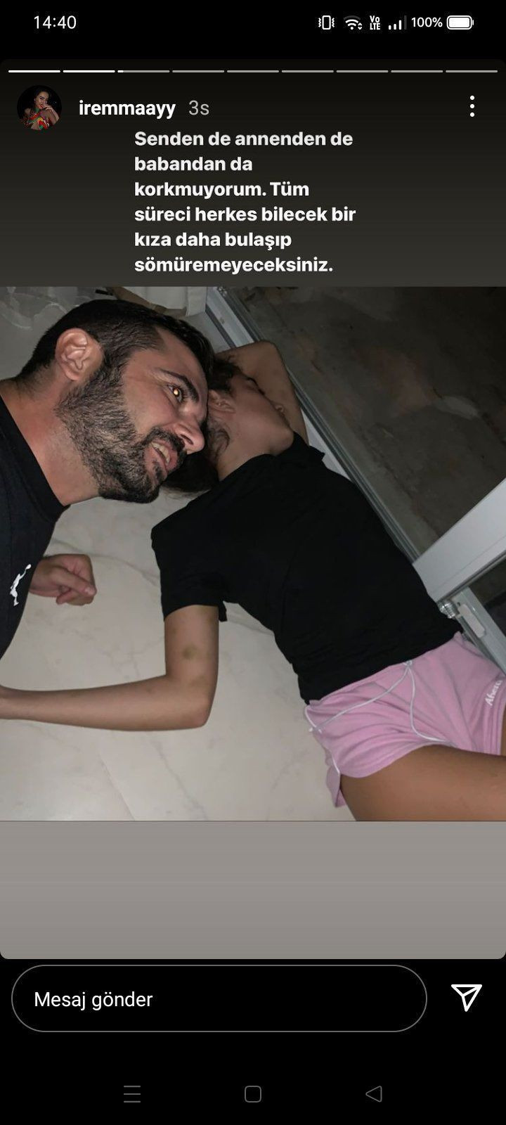 Fenomen isme işkence anları! İrem Ay işkence gördüğü görüntüleri sosyal medyadan paylaştı - Resim: 3