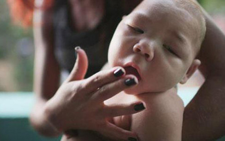 Zika; Dünyanın yeni kabusu!