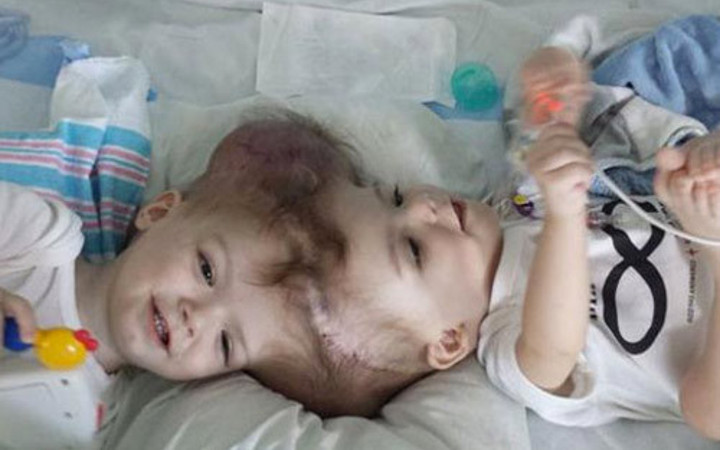 10 milyonda bir görülüyor! Mucize kurtuluş