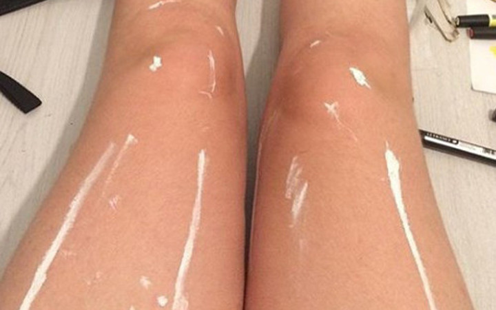 Bu bacaklarda ne görüyorsunuz?