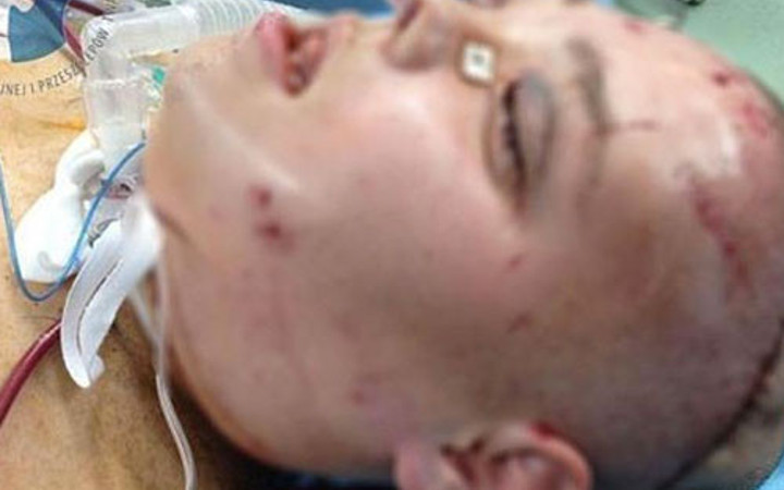 Yüz nakli sonrası inanılmaz değişim! Yok artık diyeceksiniz