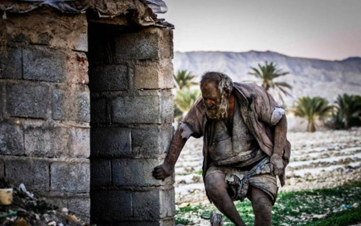 Ne traş oluyor ne banyo yapıyor 60 yıldır suya dokunmuyor!