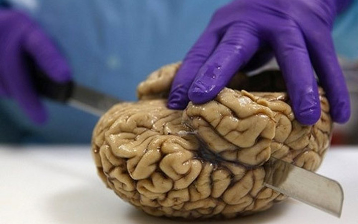 Sperm bankasından sonra şimdi de… Sadece 48 saatiniz var