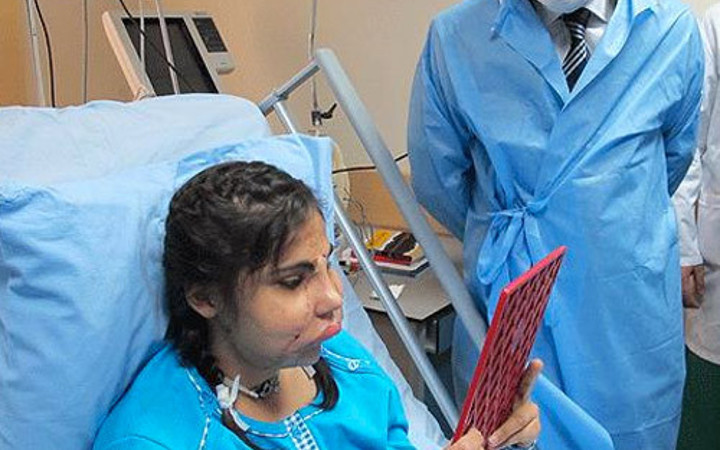 Türkiye'nin yüz nakli yapılan ilk kadını Hatice Nergis hayatını kaybetti