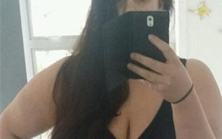 90 kilo verdi yetmedi estetik ameliyat oldu