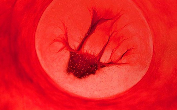 Regl kanıyla fotoğraf yaptı sanat eseri dedi!