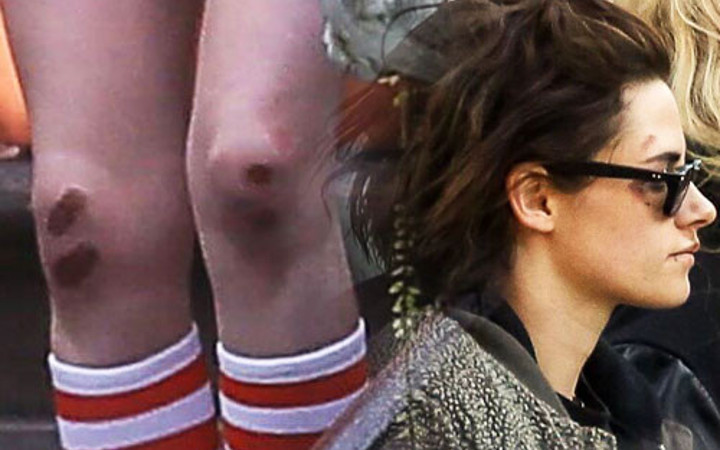 Dünyaca ünlü yıldız içler acısı halde şiddet mi gördü