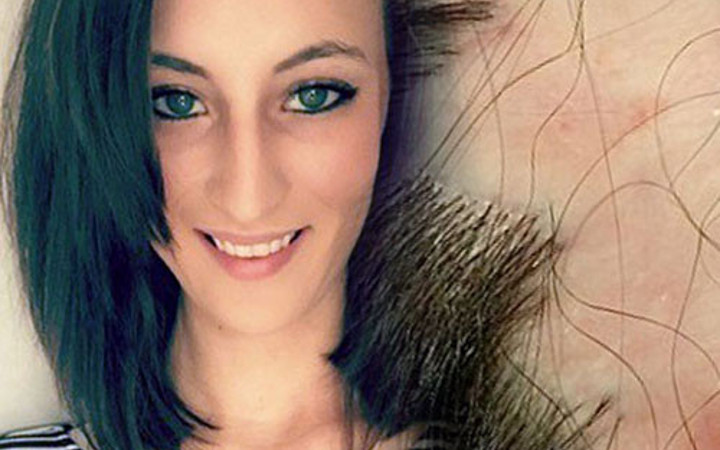 Kuaför hatası bakın ne yaptı korkunç!