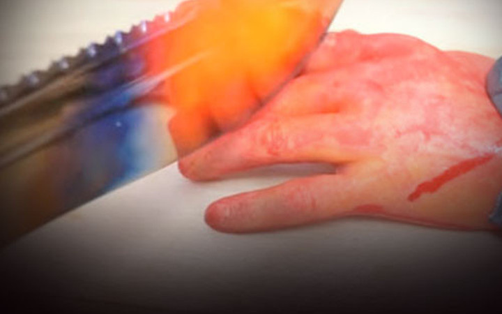 Herşeyi kızgın bıçakla kesti bakın ne oldu