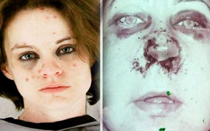 Uyuşturucudan bu haldeydi şimdi bambaşka!