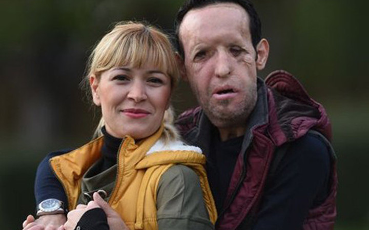 Yüzleri de hayatları da değişti