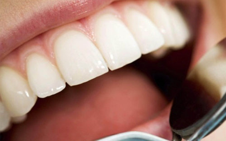 Dişlerinizi alüminyum folyo ile kaplayın 1 saat içerisinde...