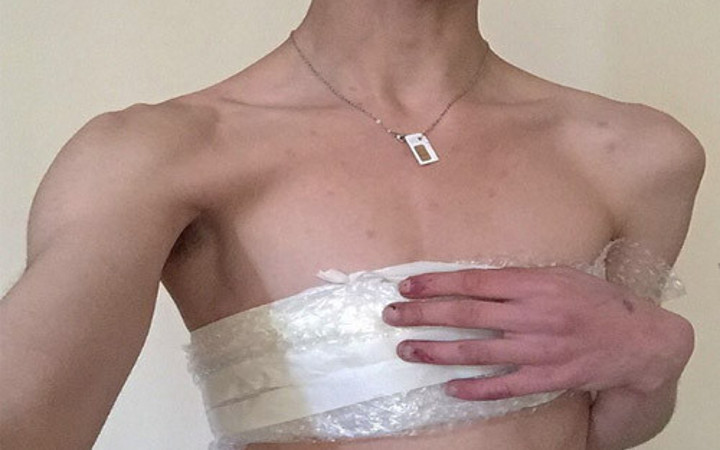 Meme uçlarını ve göbek deliğini aldırdı! Üstüne bir de satışa çıkardı...