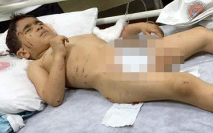 Van'da dehşet 8 köpek 5 yaşındaki çocuğa saldırdı