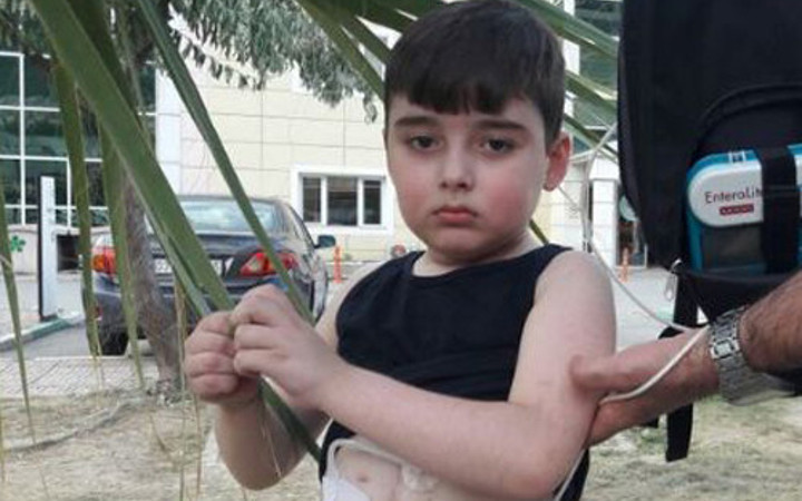 5 yılda tam 70 ameliyat geçirdi